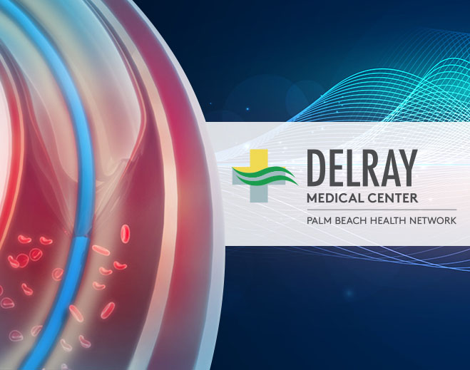 delray-polarx-659x519