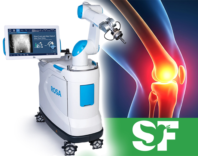 ROSA Robotics Knee System